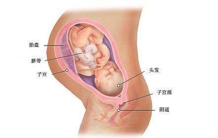 胎儿入盆图片 胎儿什么时候入盆