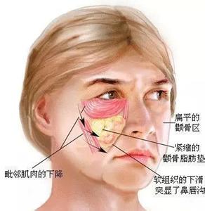 胶原蛋白挑选 应该怎么挑选胶原蛋白？