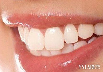 牙齿不整齐 成人牙齿长歪了怎么办呢？4个步骤让你拥有整齐牙齿(2)