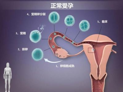 有什么方法容易受孕 受孕的方法有哪些