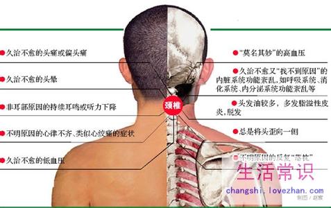 颈椎病的症状表现 盘点颈椎病发作时的4个症状表现