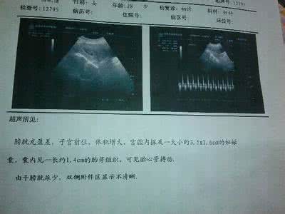 孕妇多久做一次b超 孕妇可以做几次b超(2)