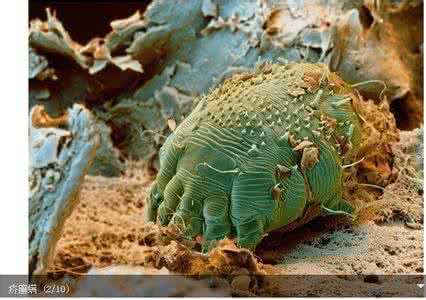 土蜂 寄生的害虫 人体十大寄生害虫