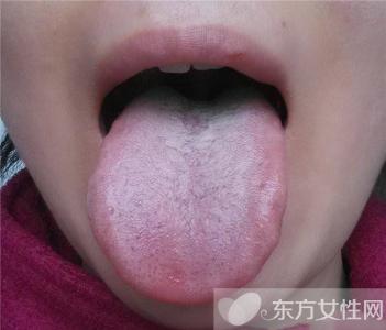 舌头发白怎么调理 什么原因会引起舌苔发白