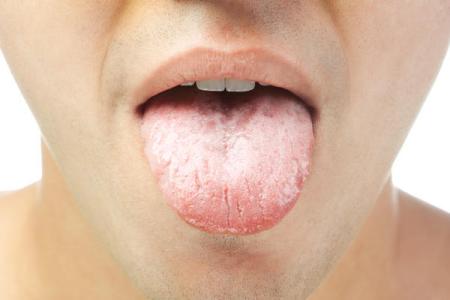 舌苔厚白吃什么药最好 舌苔能反映出什么