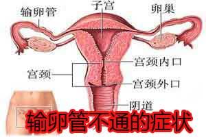 输卵管不通自查方法 输卵管不通的症状