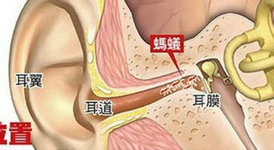 飞虫进耳朵里了怎么办 耳朵进了飞虫怎么办