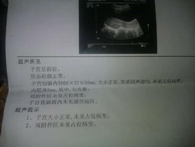 b超能检查出什么妇科病 B超检查什么