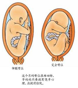 快速散瞳后注意事项 快速怀孕注意事项