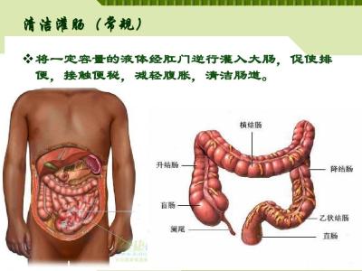 清洁肠道的食物 三种食物治疗便秘 清洁肠道