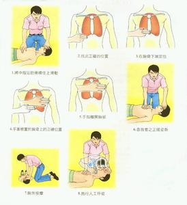 日常急救小常识 9种日常急救