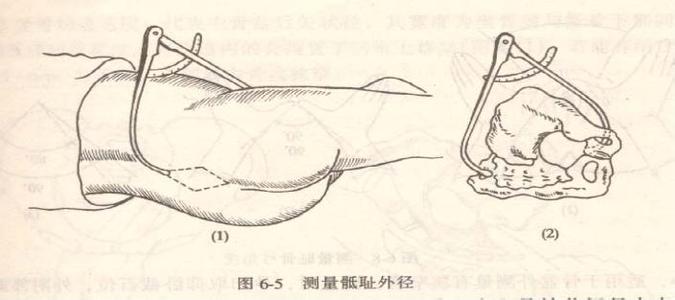 孕多少周测量骨盆 什么时候骨盆测量