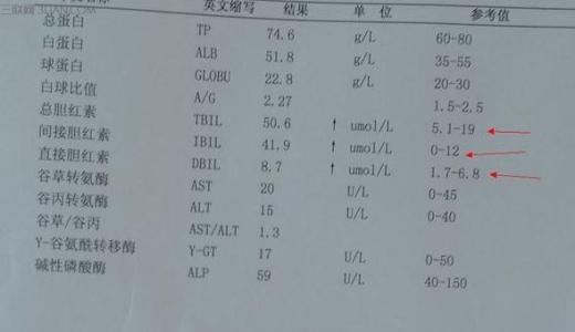 肝脏属于什么系统 总胆红素高小心肝脏系统出问题