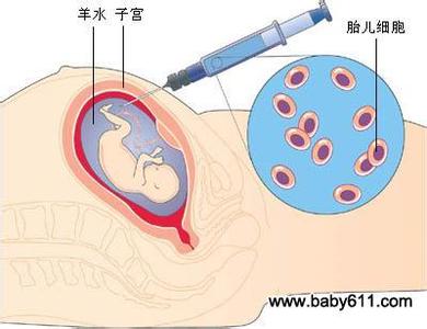 肺栓塞高危因素 羊水栓塞的高危人群