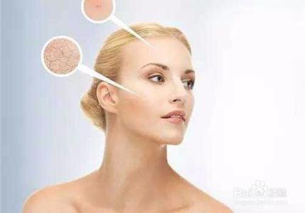 脸部缺水起皮 如何避免肌肤缺水起皮？