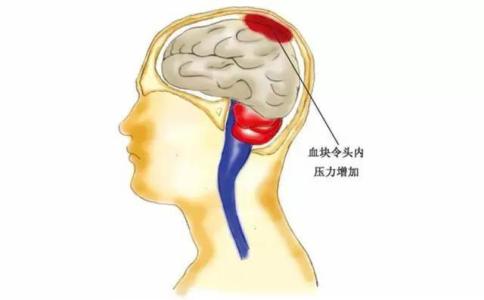 带脉对身体的七大作用 身体“崩溃”的七大信号