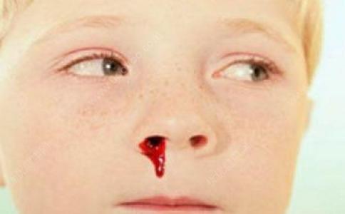流鼻血是什么病的前兆 小孩流鼻血是什么原因