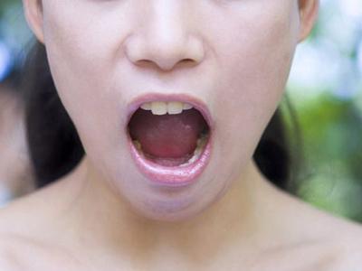 口腔溃疡食物疗法 口腔溃疡的食物疗法