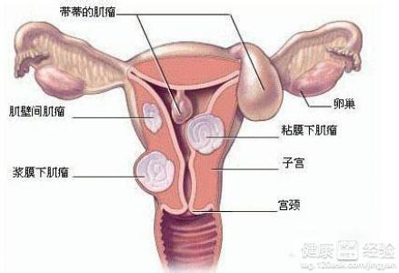 10大败家行为 有损子宫健康的10大不良行为