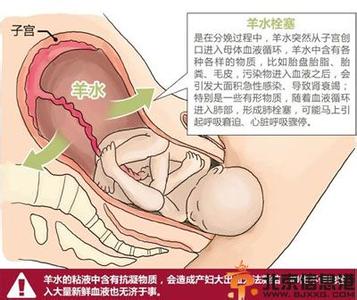 羊水栓塞的早期症状 羊水栓塞的症状