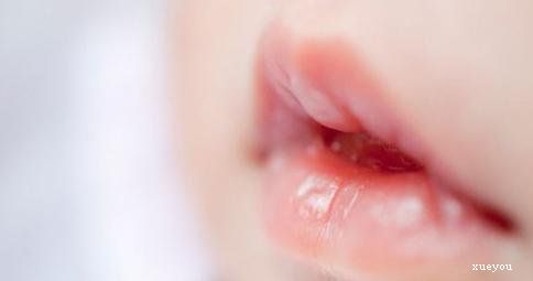 嘴唇干燥用什么方法 预防嘴唇干燥的方法