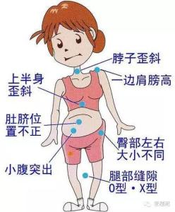 女人我最大拯救骨盆 自检你的骨盆变形了吗以及拯救