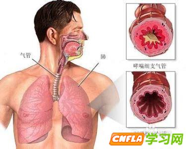 支气管炎如何根治 气管炎治疗方法