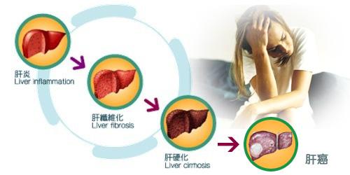 预防肝病的食物 预防肝病可以吃哪些食物
