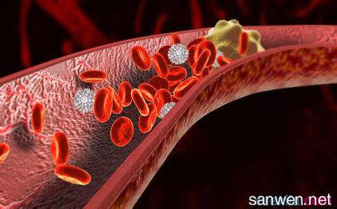 什么是血栓形成 血栓形成的基本条件