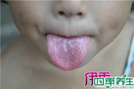 舌头根起泡食疗方法 舌头起泡的治疗方法