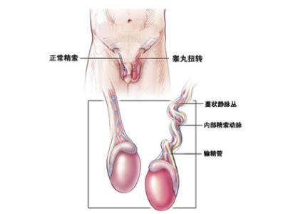 偶尔睾丸痛是怎么了 睾丸偶尔疼痛是怎么回事