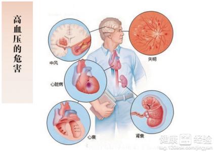 高血压的早期症状 高血压的原因及早期症状