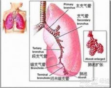 肺心病吃什么药效果好 肺病吃什么好 吃什么对肺心病好