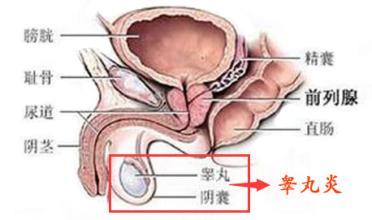 睾丸炎能自愈吗 睾丸炎的原因