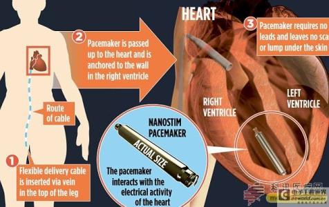 心脏病是怎样形成的 心脏病是怎样形成的 心脏病检查和治疗