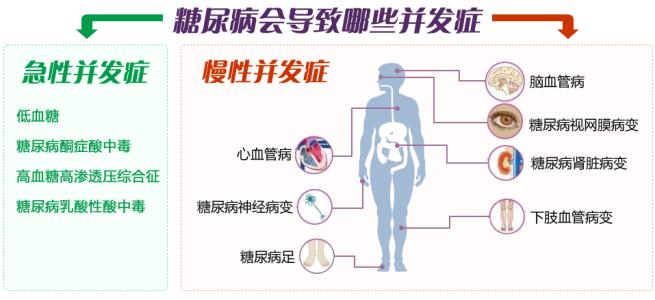 糖尿病并发症能活多久 糖尿病并发症有哪些