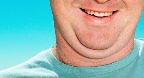 不胖现双下巴的原因 双下巴形成的原因