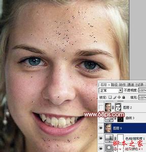 photoshop去痘痘 用photoshop去痘痘的方法
