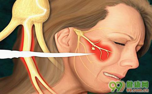 三叉神经痛中医治疗 三叉神经痛中医的治疗方法