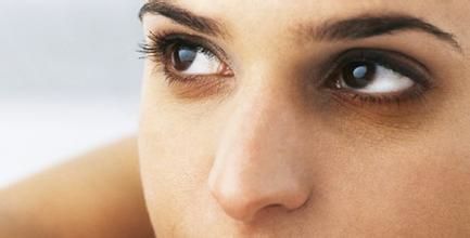 黑眼圈的形成原因 形成黑眼圈的原因有哪些
