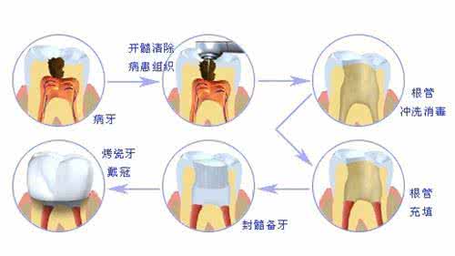 枕大神经痛最有效治疗 牙神经痛吃什么药_有效治疗牙神经痛的药