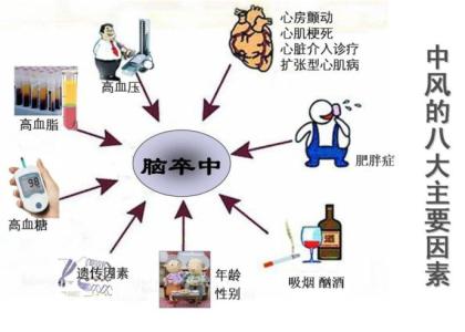 2016中国脑卒中发病率 2016年脑卒中发病原因