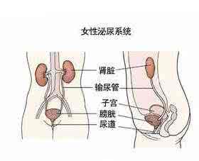 什么原因造成尿路感染 什么原因导致尿路感染