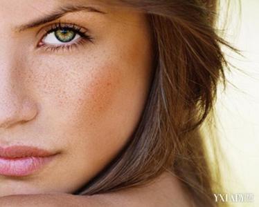女人脸上长斑的原因 35岁女人长斑原因揭秘