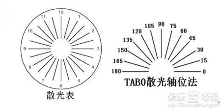 治疗眼睛散光的方法 散光眼的治疗方法