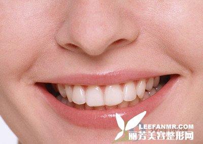 让牙齿变白的最快方法 怎么样能让牙齿变白