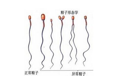 精子畸形率99成功怀孕 导致精子畸形的原因