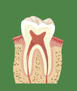 根管治疗后牙齿松动 根管治疗后牙齿松动怎么办