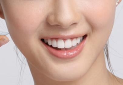 牙齿整形美容方法 牙齿美容的方法有哪些