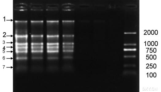 hcvrna是什么意思 什么是rna rna有什么用